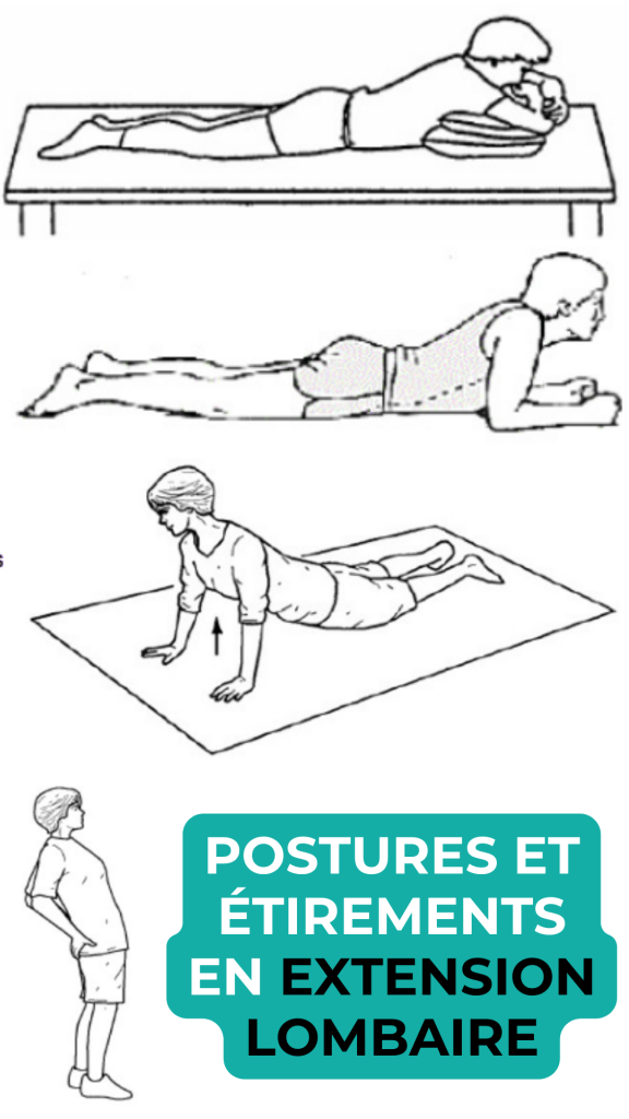 examples of exercises for lumbar stenosis (narrow lumbar canal) performed by a physiotherapist